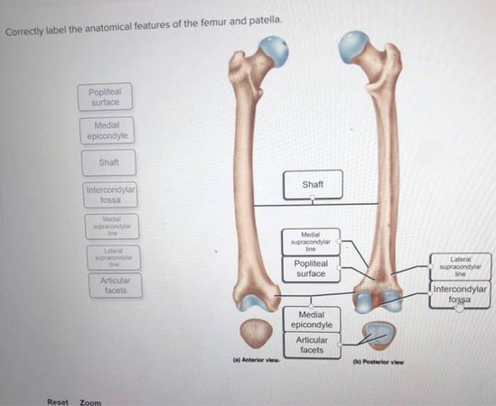 Correctly label the anatomical features of the humerus