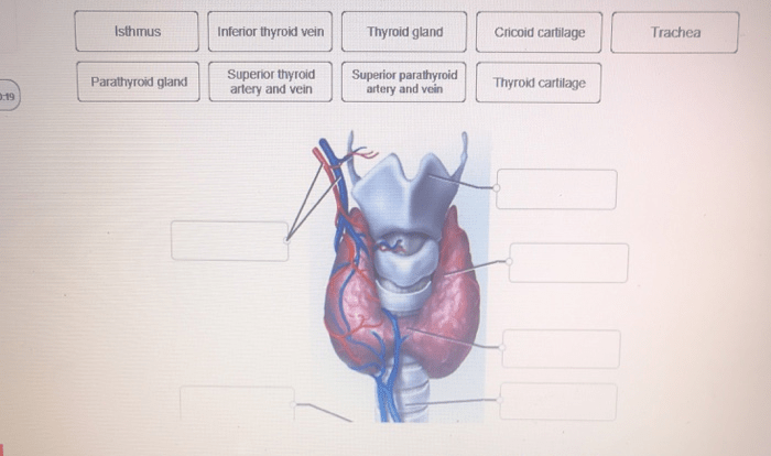 Correctly label the following gross anatomy of the gland