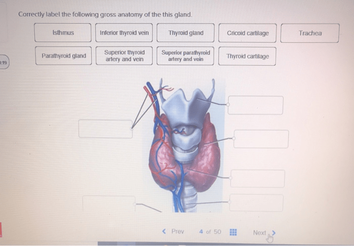 Correctly label the following gross anatomy of the gland